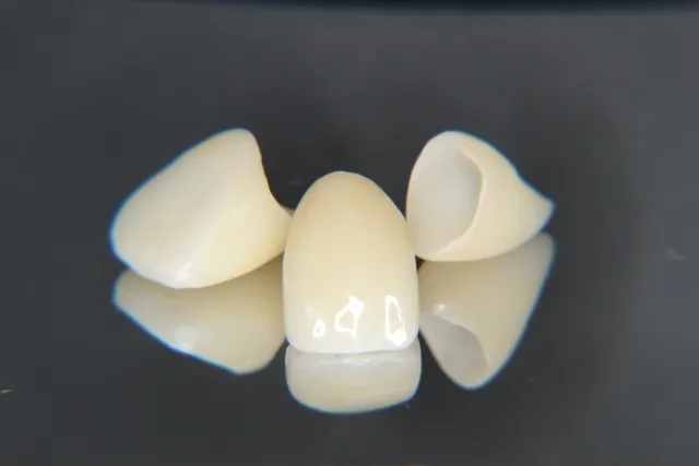 審美歯科のセラミック素材のイメージ画像