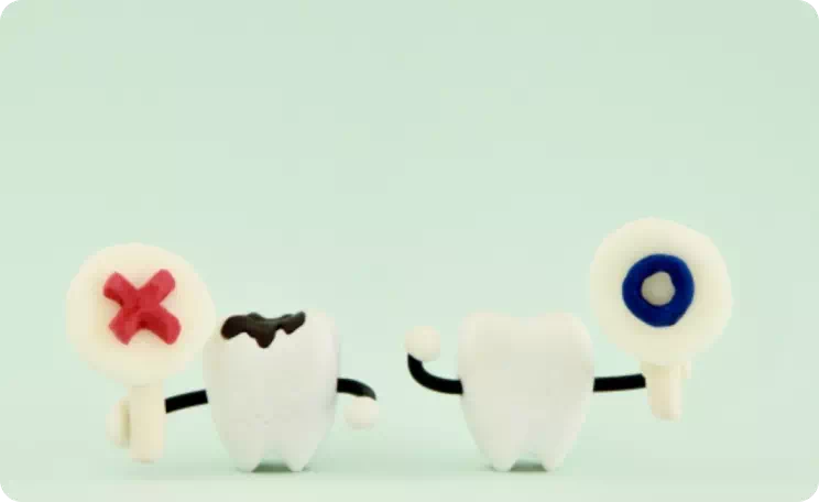 虫歯のイメージ画像