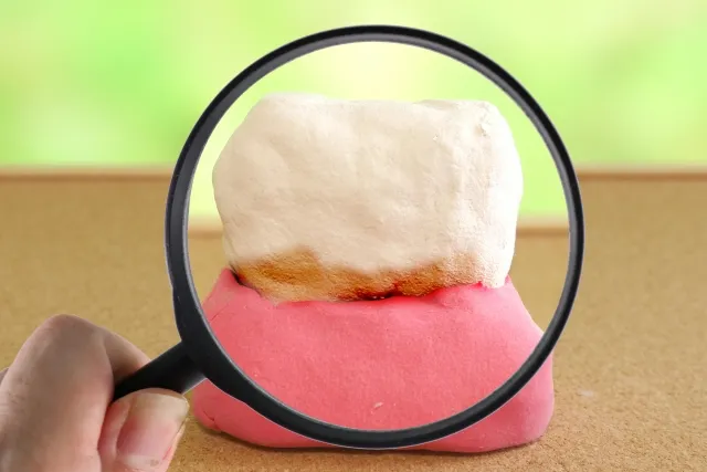 予防歯科のイメージ画像