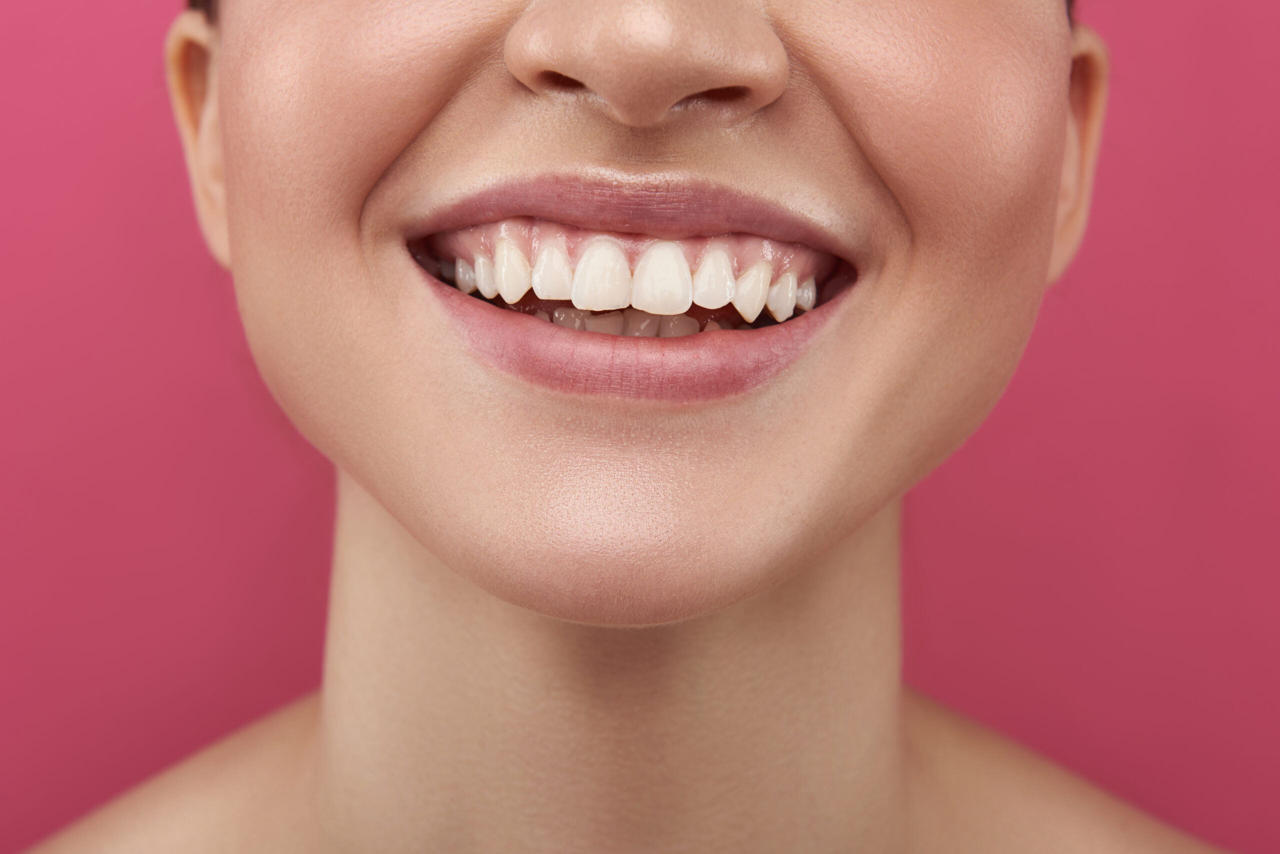 歯肉形成のイメージ画像